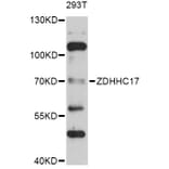 Western Blot - Anti-ZDHHC17 Antibody (A4545) - Antibodies.com