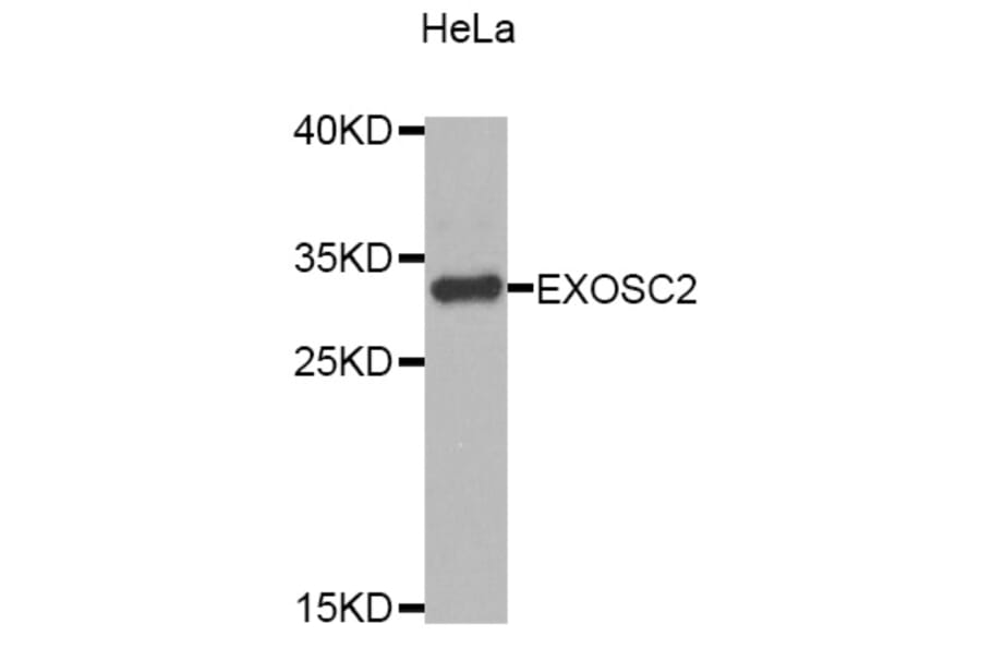 Western Blot - Anti-EXOSC2 Antibody (A4549) - Antibodies.com