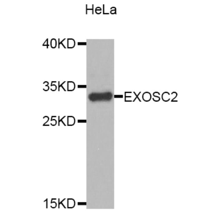 Western Blot - Anti-EXOSC2 Antibody (A4549) - Antibodies.com