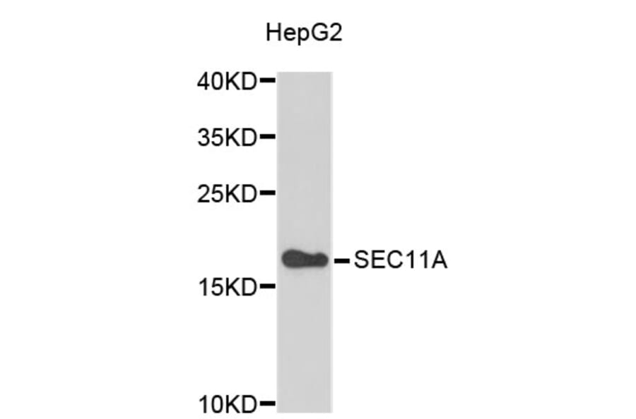 Western Blot - Anti-SEC11A Antibody (A4556) - Antibodies.com