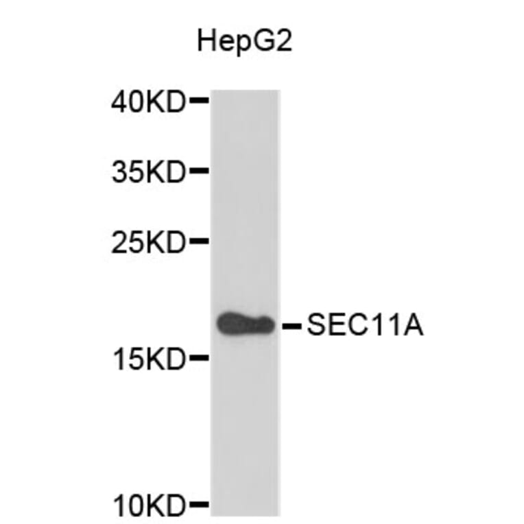 Western Blot - Anti-SEC11A Antibody (A4556) - Antibodies.com