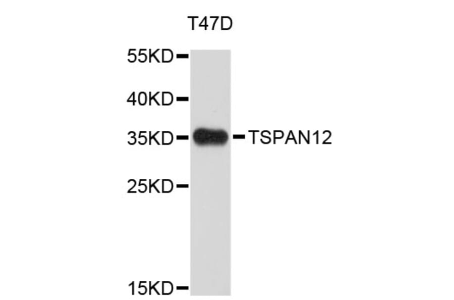 Western Blot - Anti-TSPAN12 Antibody (A4564) - Antibodies.com
