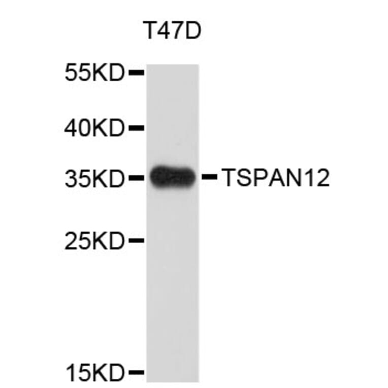 Western Blot - Anti-TSPAN12 Antibody (A4564) - Antibodies.com