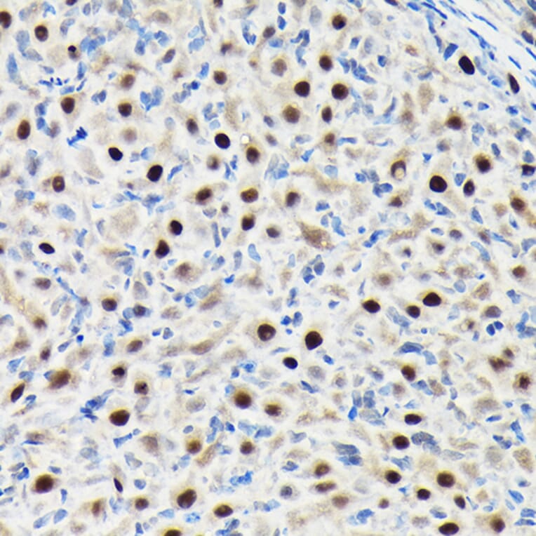 Immunohistochemistry - Anti-GTPBP4/NOG1 Antibody (A9503) - Antibodies.com