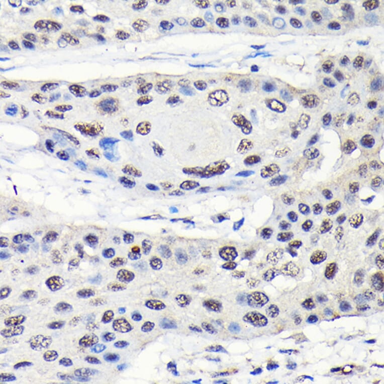 Immunohistochemistry - Anti-GTPBP4/NOG1 Antibody (A9503) - Antibodies.com