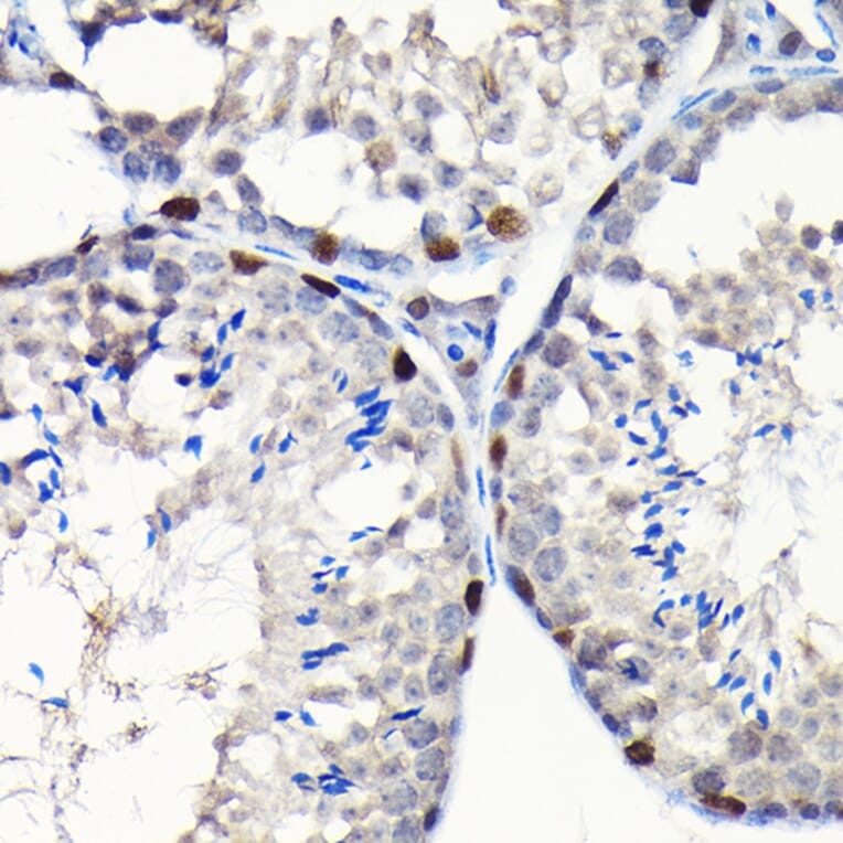 Immunohistochemistry - Anti-GTPBP4/NOG1 Antibody (A9503) - Antibodies.com