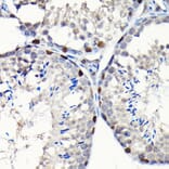 Immunohistochemistry - Anti-GTPBP4/NOG1 Antibody (A9503) - Antibodies.com