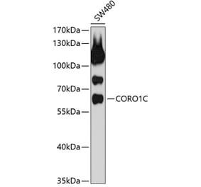 Western Blot - Anti-Coronin-1C Antibody (A9504) - Antibodies.com