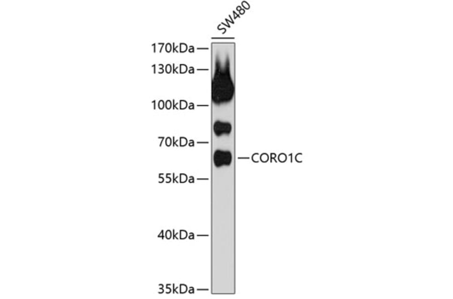 Western Blot - Anti-Coronin-1C Antibody (A9504) - Antibodies.com