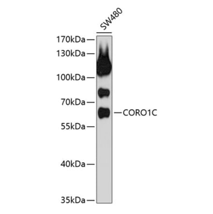 Western Blot - Anti-Coronin-1C Antibody (A9504) - Antibodies.com