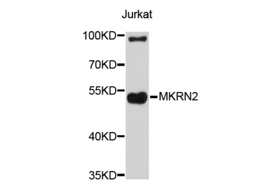 Western Blot - Anti-MKRN2 Antibody (A4570) - Antibodies.com
