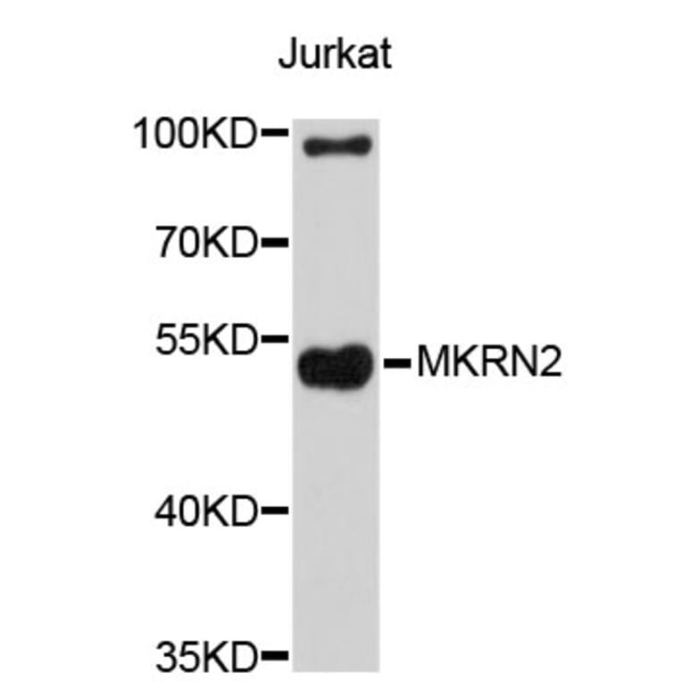 Western Blot - Anti-MKRN2 Antibody (A4570) - Antibodies.com