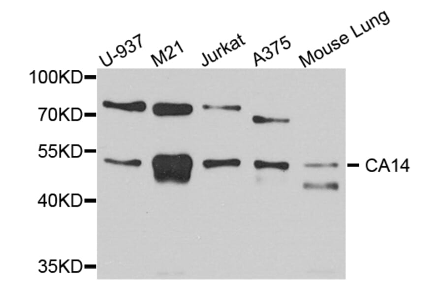 Western Blot - Anti-CA14 Antibody (A4573) - Antibodies.com