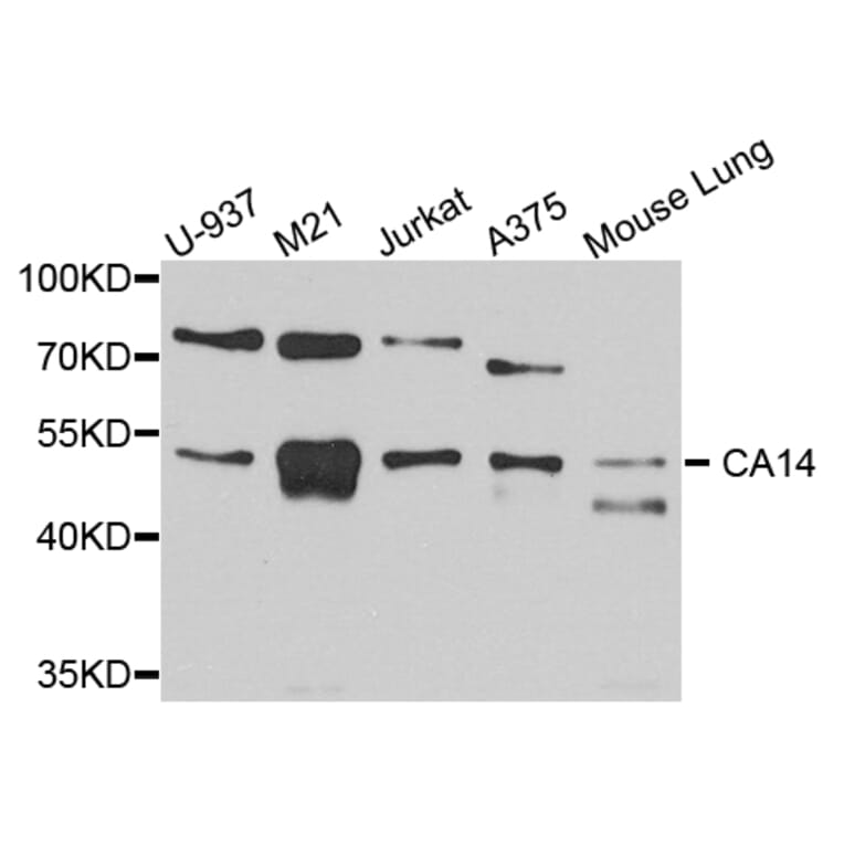 Western Blot - Anti-CA14 Antibody (A4573) - Antibodies.com