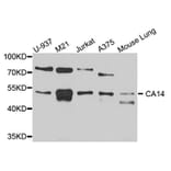 Western Blot - Anti-CA14 Antibody (A4573) - Antibodies.com
