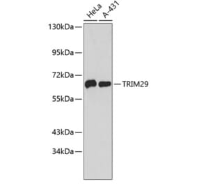 Western Blot - Anti-TRIM29 Antibody (A9509) - Antibodies.com
