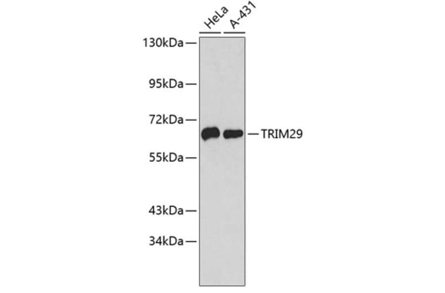 Western Blot - Anti-TRIM29 Antibody (A9509) - Antibodies.com