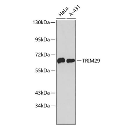 Western Blot - Anti-TRIM29 Antibody (A9509) - Antibodies.com