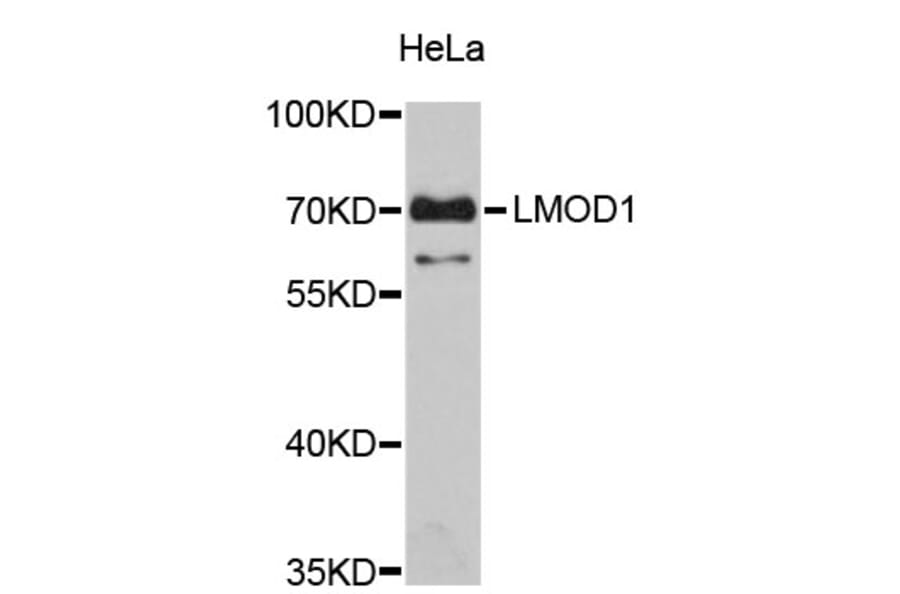 Western Blot - Anti-LMOD1 Antibody (A4585) - Antibodies.com