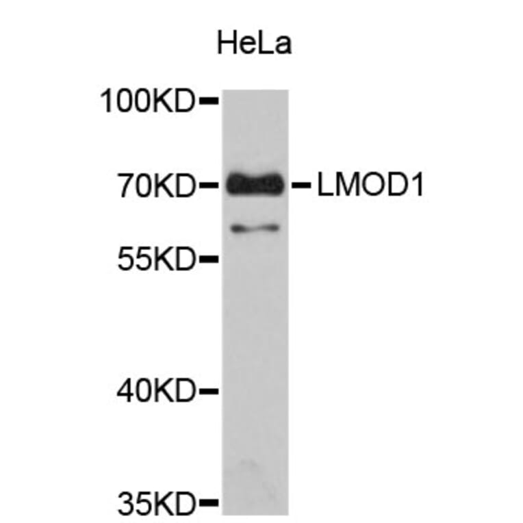 Western Blot - Anti-LMOD1 Antibody (A4585) - Antibodies.com