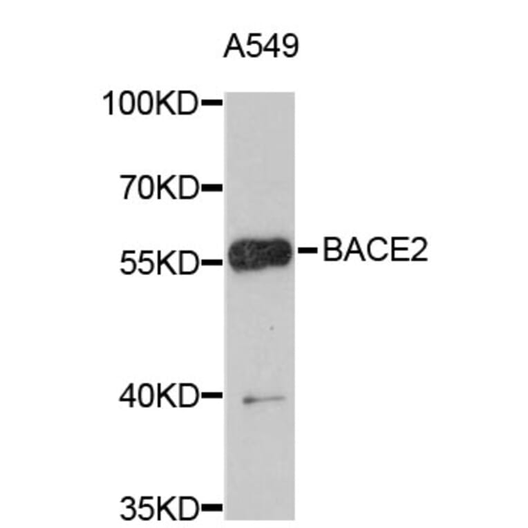 Western Blot - Anti-BACE2 Antibody (A4588) - Antibodies.com