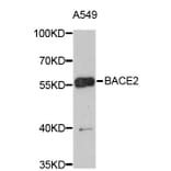 Western Blot - Anti-BACE2 Antibody (A4588) - Antibodies.com