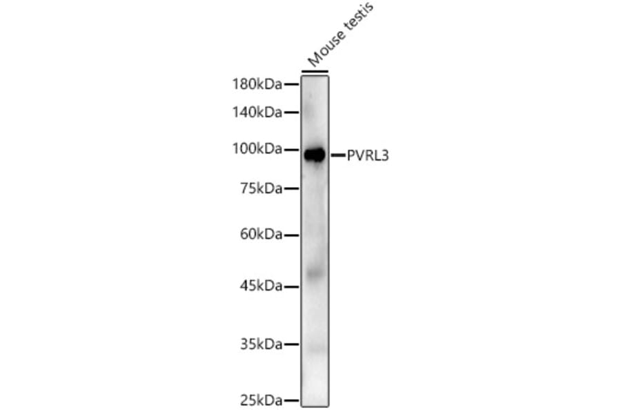 Western Blot - Anti-Nectin 3 Antibody (A9512) - Antibodies.com