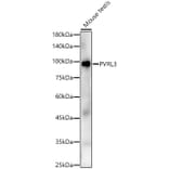 Western Blot - Anti-Nectin 3 Antibody (A9512) - Antibodies.com