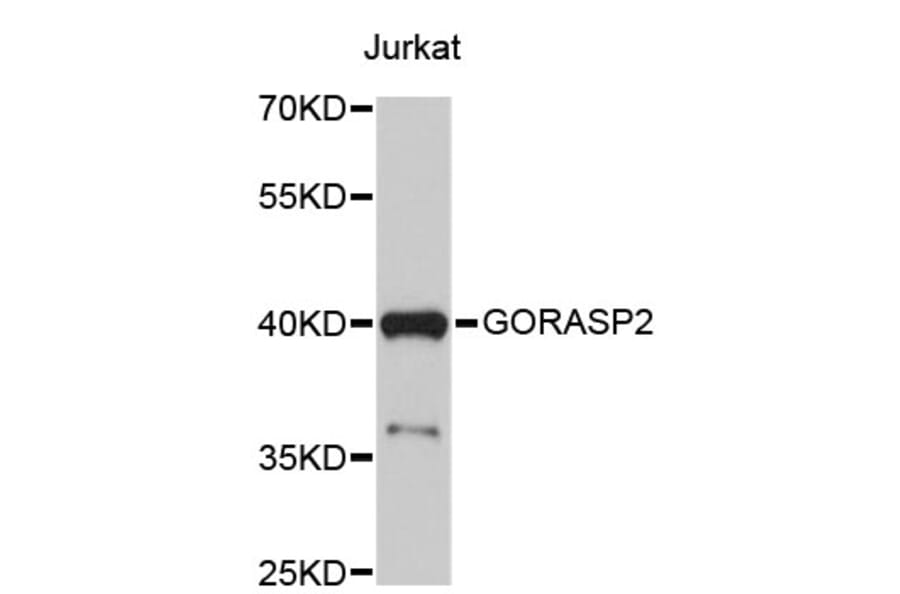 Western Blot - Anti-GORASP2 Antibody (A4601) - Antibodies.com