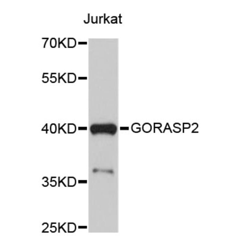 Western Blot - Anti-GORASP2 Antibody (A4601) - Antibodies.com