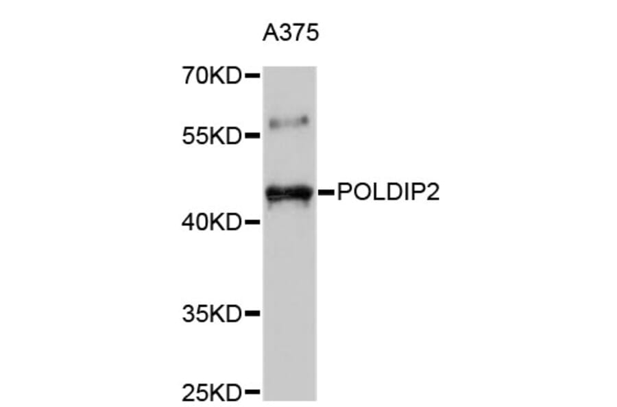 Western Blot - Anti-POLDIP2 Antibody (A4608) - Antibodies.com