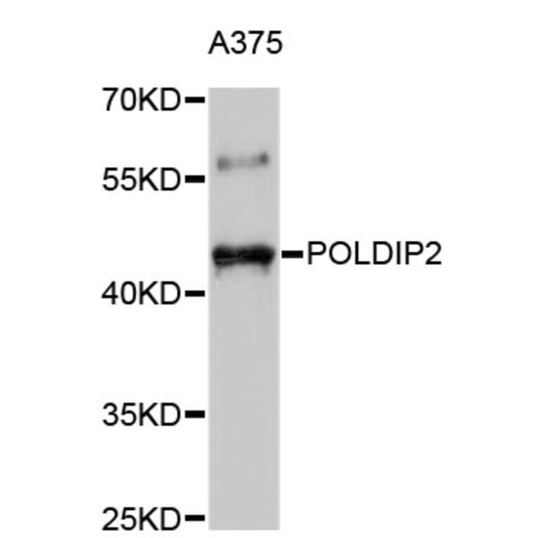 Western Blot - Anti-POLDIP2 Antibody (A4608) - Antibodies.com