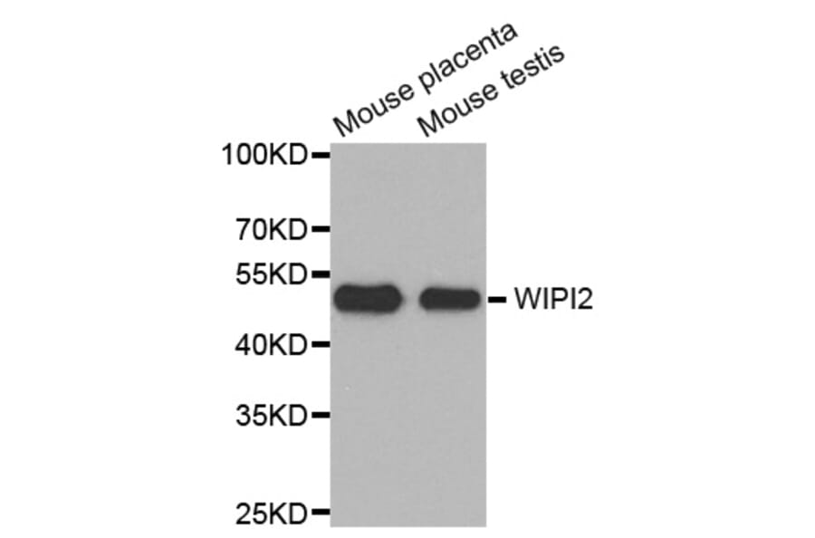 Western Blot - Anti-WIPI2 Antibody (A4610) - Antibodies.com