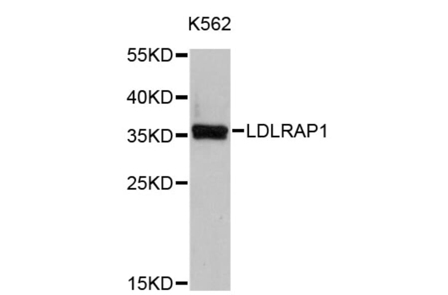 Western Blot - Anti-LDLRAP1 Antibody (A4611) - Antibodies.com