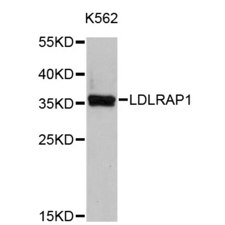 Western Blot - Anti-LDLRAP1 Antibody (A4611) - Antibodies.com