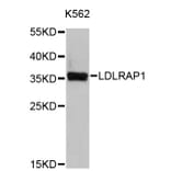 Western Blot - Anti-LDLRAP1 Antibody (A4611) - Antibodies.com