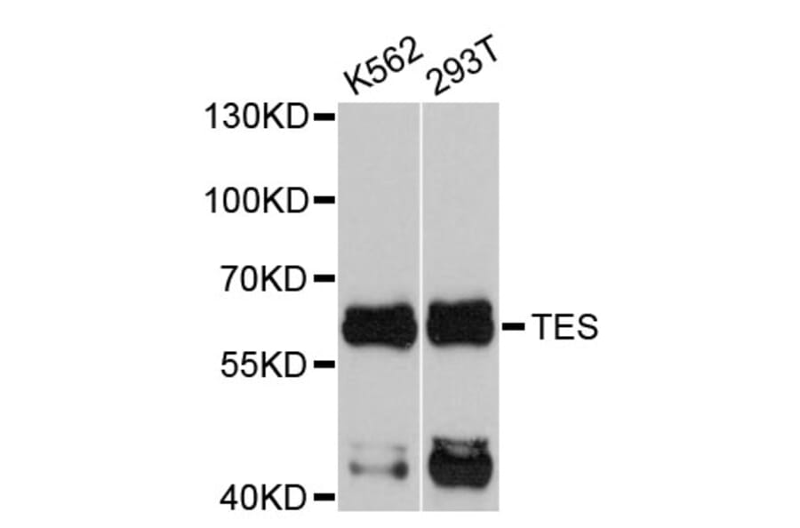 Western Blot - Anti-TES Antibody (A4613) - Antibodies.com