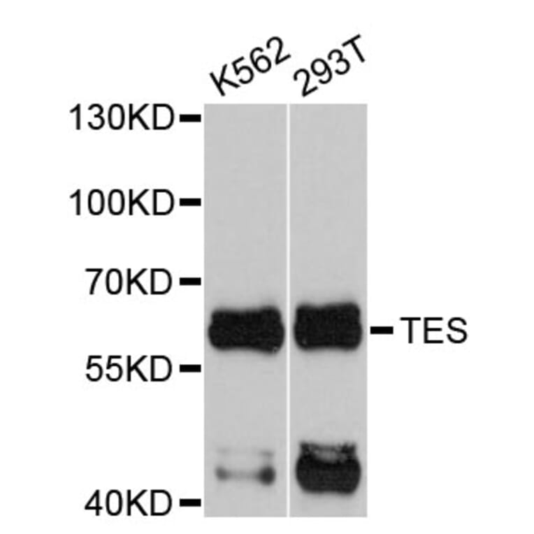 Western Blot - Anti-TES Antibody (A4613) - Antibodies.com