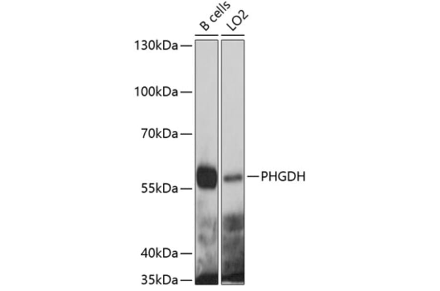 Western Blot - Anti-PHGDH Antibody (A4617) - Antibodies.com