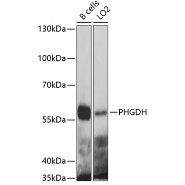 Western Blot - Anti-PHGDH Antibody (A4617) - Antibodies.com