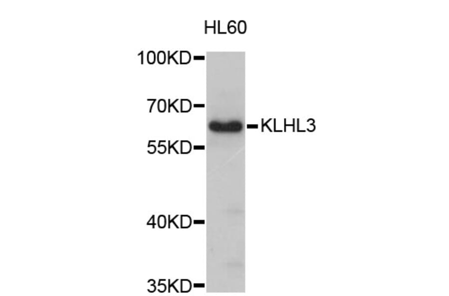 Western Blot - Anti-KLHL3 Antibody (A4618) - Antibodies.com