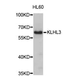 Western Blot - Anti-KLHL3 Antibody (A4618) - Antibodies.com