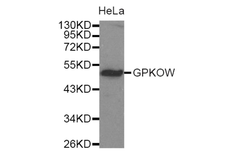 Western Blot - Anti-GPKOW Antibody (A4652) - Antibodies.com