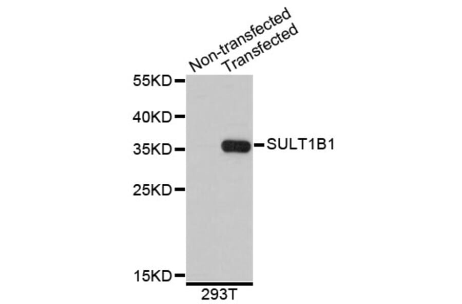 Western Blot - Anti-SULT1B1 Antibody (A4654) - Antibodies.com