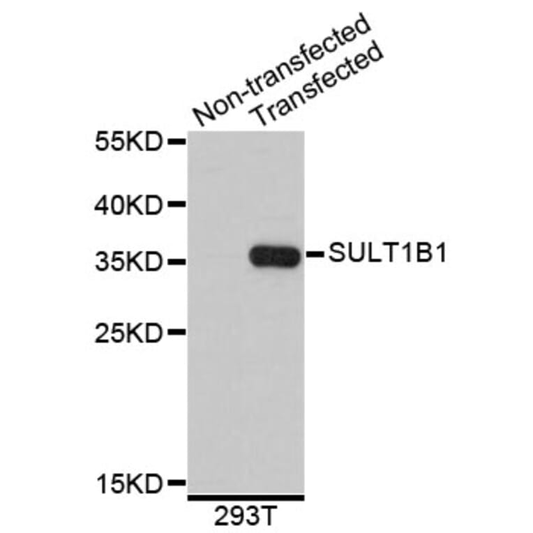 Western Blot - Anti-SULT1B1 Antibody (A4654) - Antibodies.com