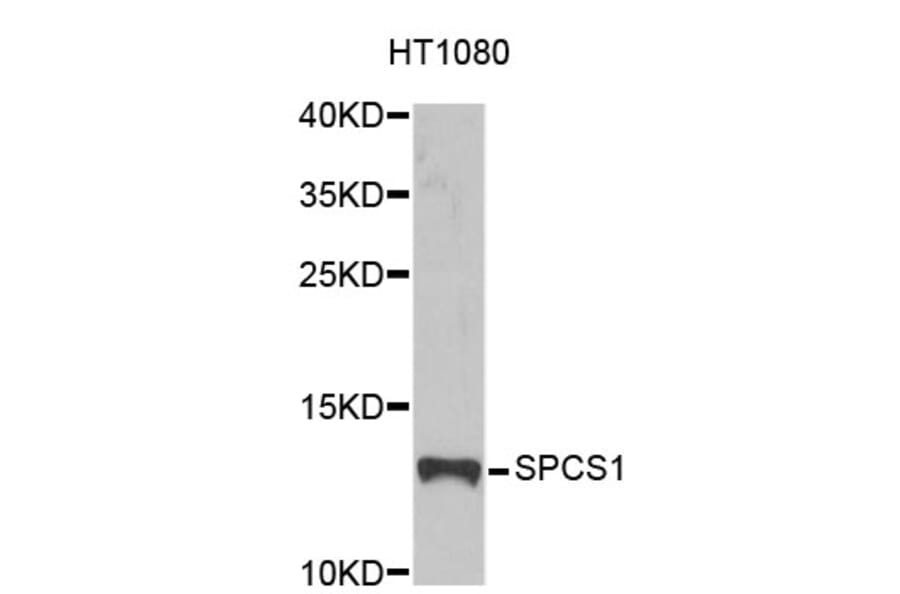 Western Blot - Anti-SPCS1 Antibody (A4661) - Antibodies.com
