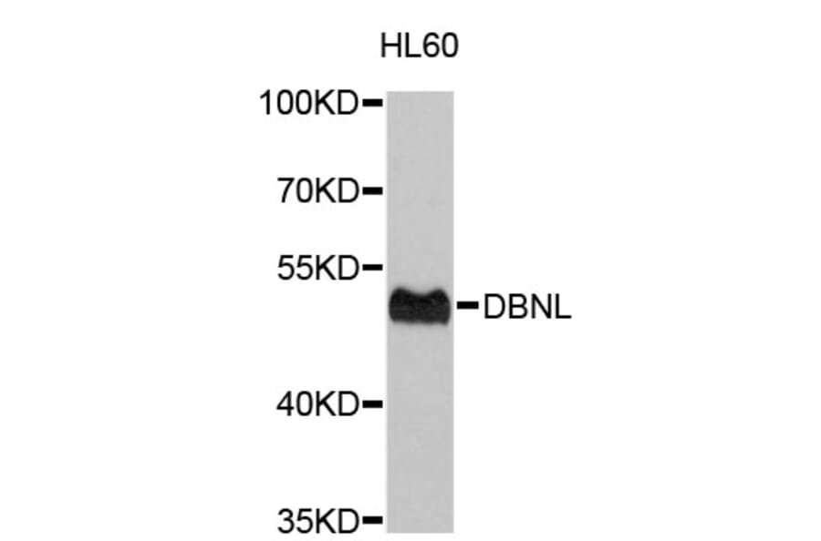 Western Blot - Anti-DBNL Antibody (A4663) - Antibodies.com