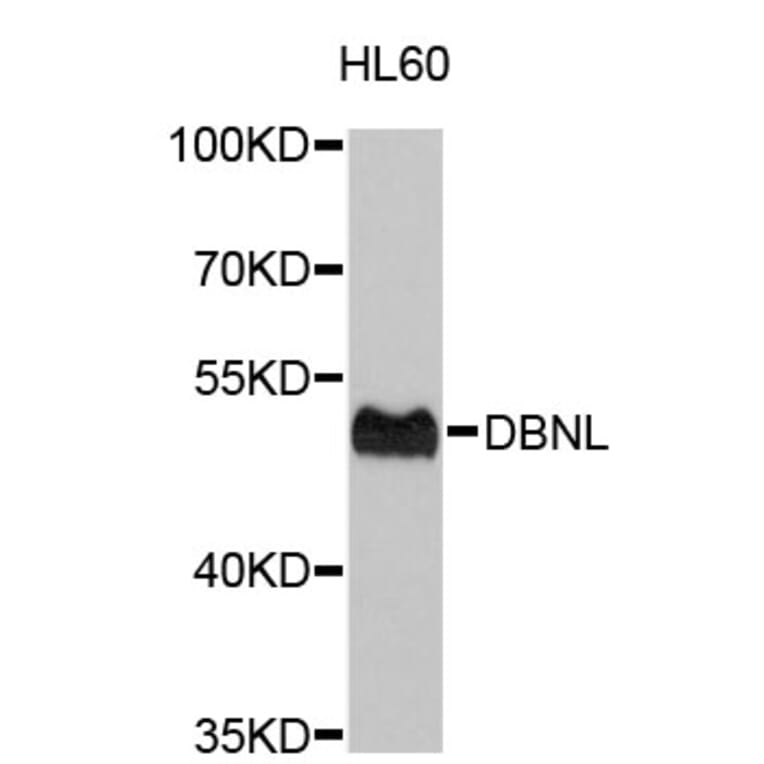 Western Blot - Anti-DBNL Antibody (A4663) - Antibodies.com