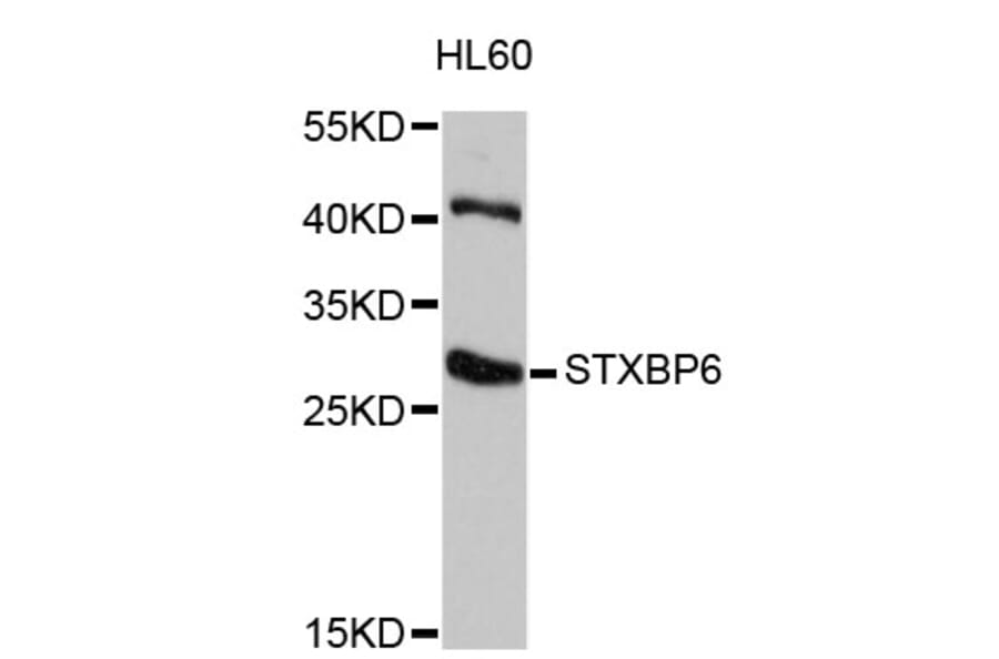 Western Blot - Anti-STXBP6 Antibody (A4667) - Antibodies.com