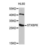 Western Blot - Anti-STXBP6 Antibody (A4667) - Antibodies.com